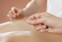 减肥埋线视频全过程,轻松减脂，重塑健康体态